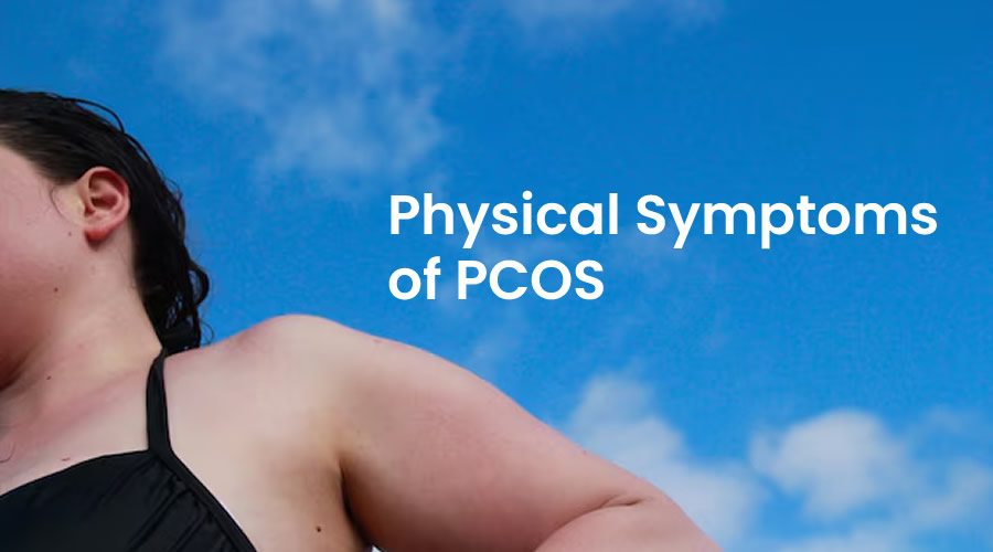 Understanding the Physical Symptoms of PCOS: FAQs